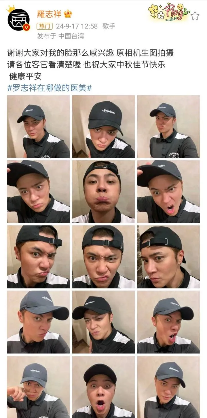羅志祥回應整形疑雲。翻攝羅志祥微博