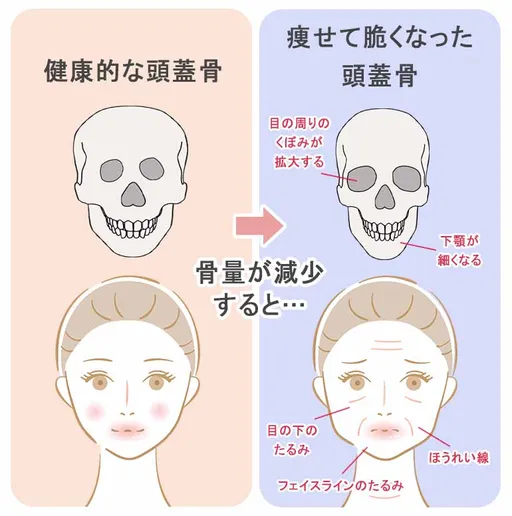 臉垮了好蒼老?快檢查「骨密度」