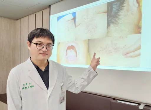 皮蛇爬满身又痛又烦人 医师吁高风险族小心!建议这样做