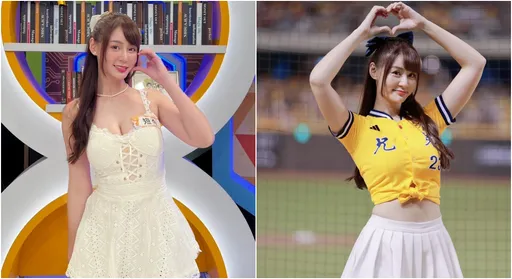 短今額頭「禿2塊」照片瘋傳!本尊認了:植髮3299根