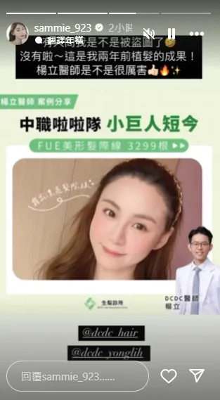 短今認了2年前去植髮。翻攝短今IG