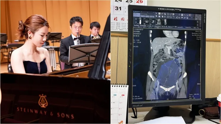 從超音波片可以看到，江老師的腫瘤相當大顆。翻攝自江老師臉書