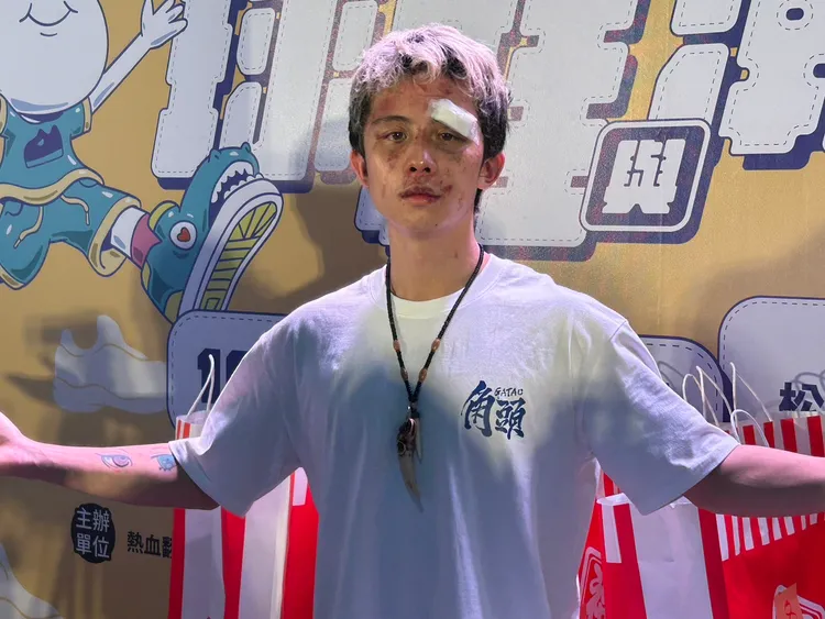 孫安佐敗給韓森，傷況曝光。資料照片