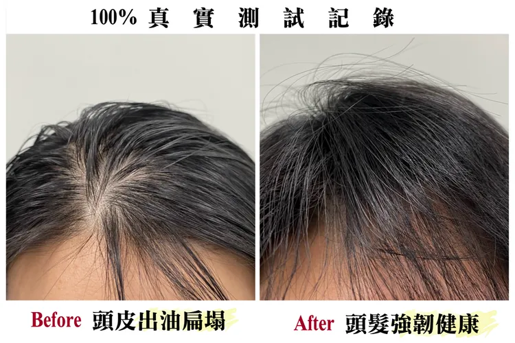 ▲ 小編實測「控油清爽健髮洗髮精+健髮精華」，原本油膩扁塌的頭髮，使用後變得明顯蓬鬆。