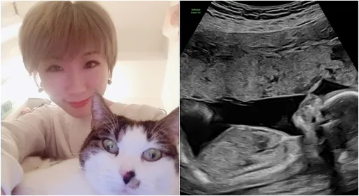 广告小妹流产3年曝喜讯 晒超音波照宣布:小聪回来了!
