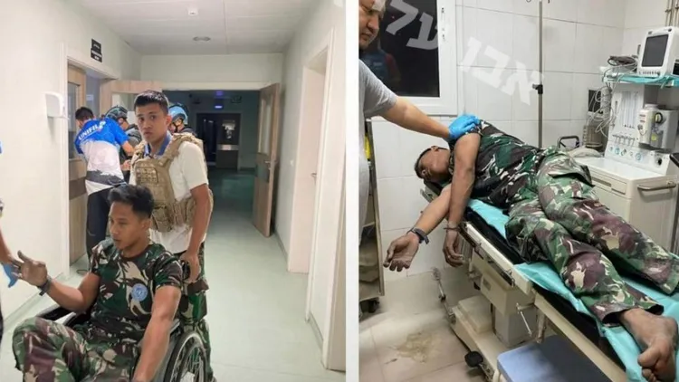 聯合國維和部隊裡中2名士兵在襲擊中受傷，1位被抬進醫護室。翻攝自X@RespectIsVital