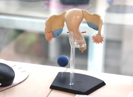 異常出血是警訊 停經後婦女當心子宮內膜癌上身