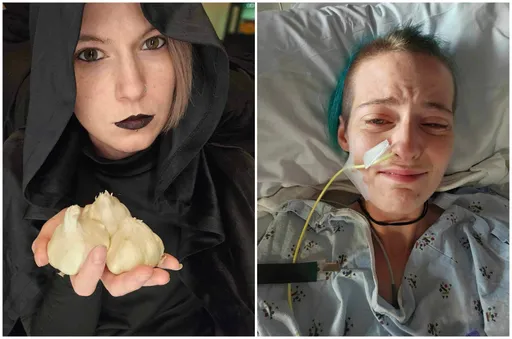 她是真实版德古拉伯爵 罹吸血鬼症候群吃大蒜恐致命