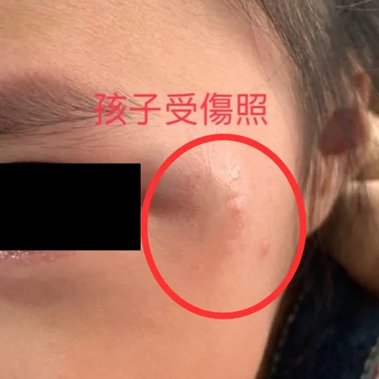 特教生遭老師推去撞椅子致傷。翻攝畫面