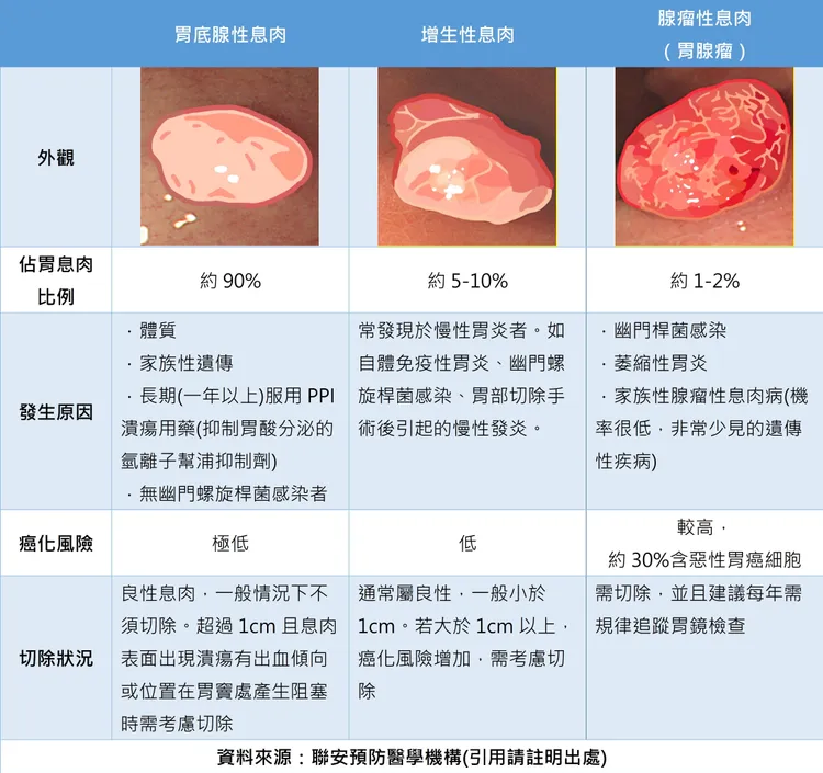 胃部息肉分類。院方提供