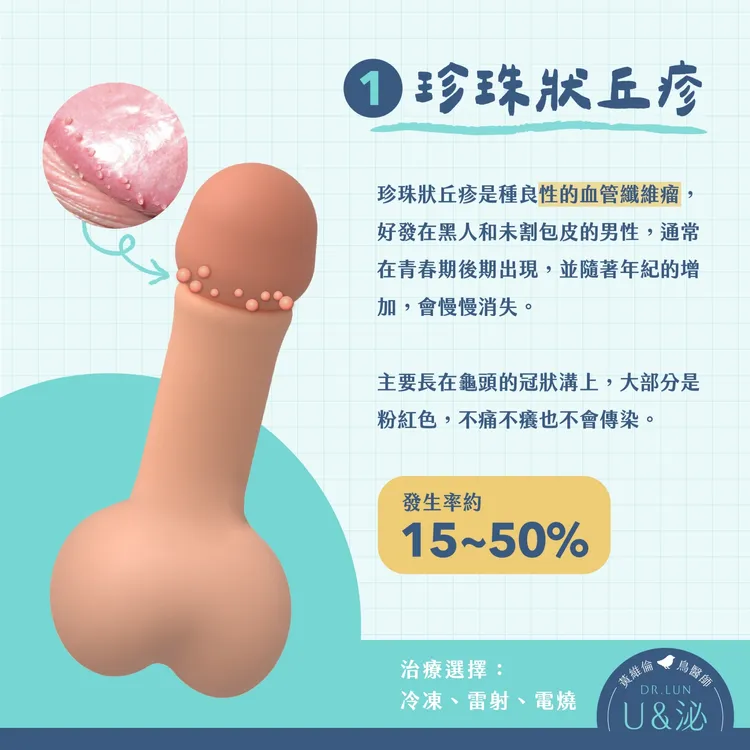 珍珠狀丘疹。取自泌尿科醫師黃維倫粉專