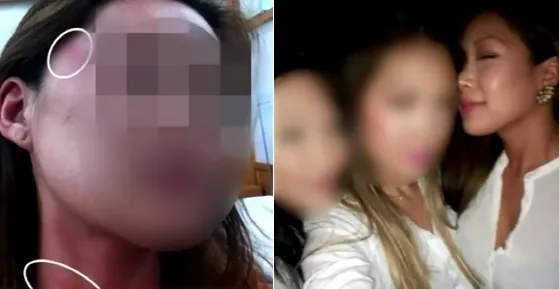 在美韓僑A女（左圖）表示2013年在梨泰院夜店也被Jessi和朋友圍毆，還把她的臉栽進馬桶。翻攝JTBC