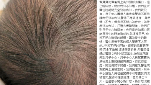 家長批禾馨未告知寶寶頭有傷 蘇怡寧:你自己也不知「這麼不關心小孩嗎」