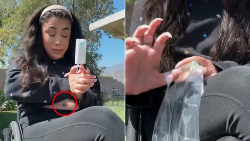 當她流淚代表「要用肚臍小便了」 26歲輪椅網紅示範驚人日常