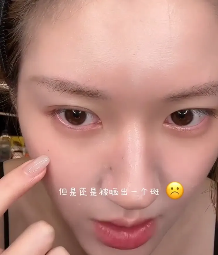 趙露思指出自己的曬斑。翻攝會火微博