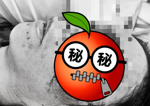 大媽踩空墜3F 視線一片黑「眼球竟掉進鼻腔」!驚悚畫面曝