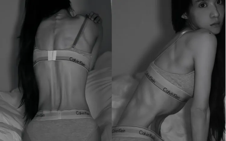 花花罹厭食症，一度瘦到皮包骨、腹部凹陷。翻攝花花臉書