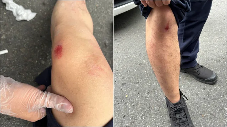 孔嫌拒檢逃逸，造成2警受傷。翻攝畫面