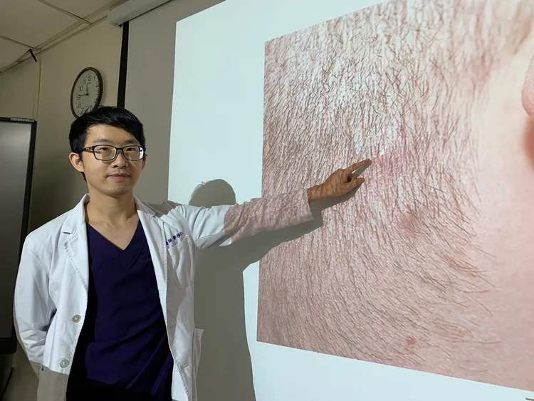 鄭惟仁醫師說，該名患者連續吃了3天的藥膳羊肉爐，結果脖子跟頭皮長滿痘痘。台中醫院提供