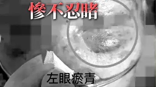 阿嬤喊「救我，外勞掐我」　掀開衣服竟渾身傷！全家人怒了