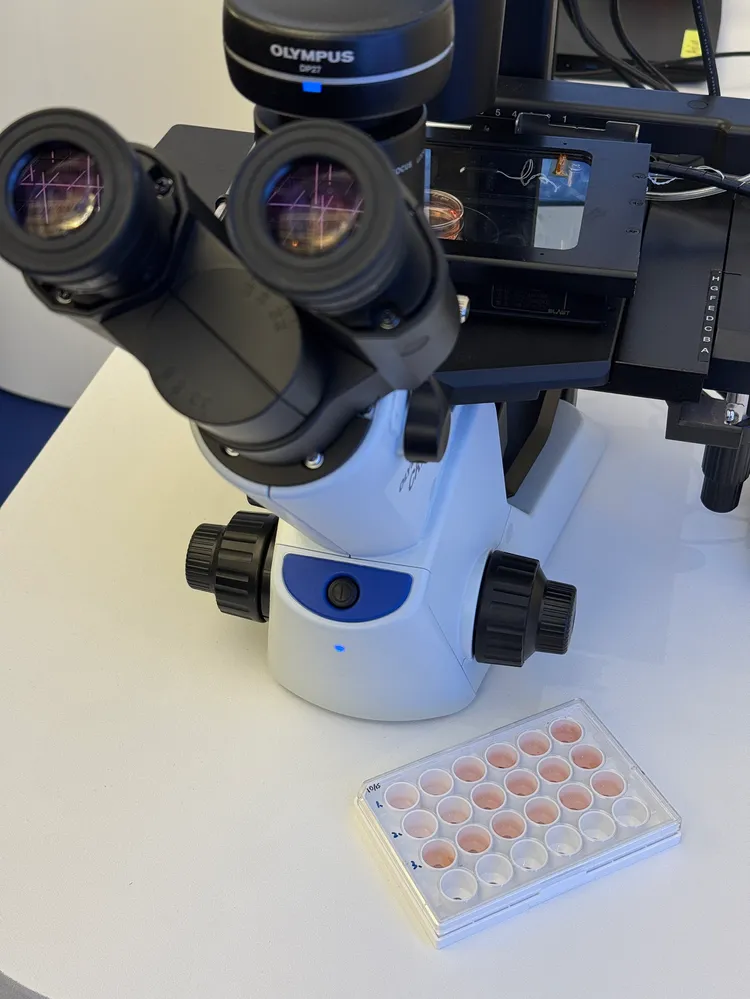 昆凌自身血液由「iPSC」培養出來的心肌細胞。彭欣偉攝