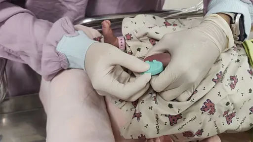 領先全球!馬偕採新生兒腳跟血 揪4A型黏多醣症