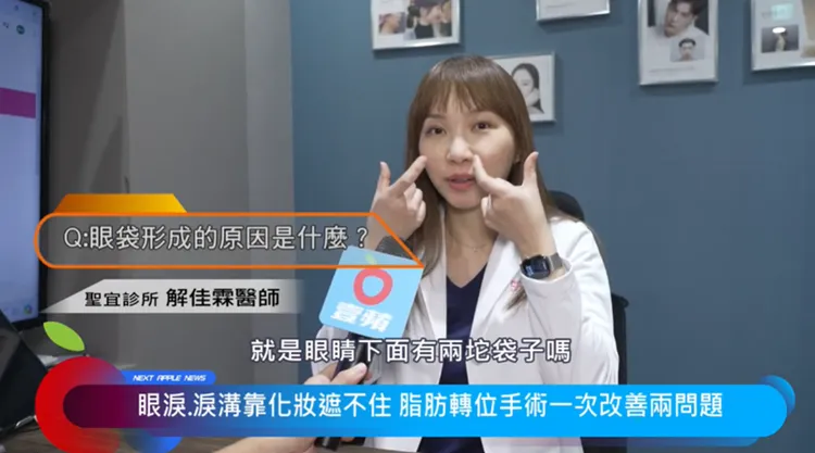 聖宜診所解佳霖醫師表示，眼袋是讓人特別顯累顯老且讓顏值大扣分的老化問題。