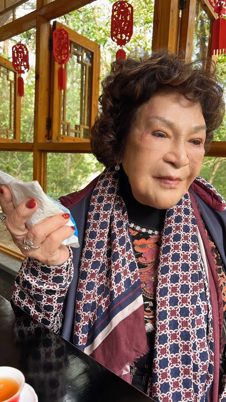 阿姑眼睛周圍受傷腫起來。李朝永提供