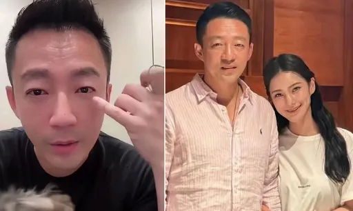 汪小菲娶醫美顧問Mandy變年輕!自曝臉上做了這項加工