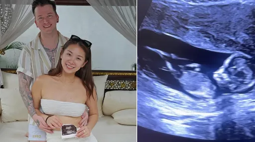 《黑澀會》米奇宣布懷孕3個月　誇另一半「基因太值得複製」