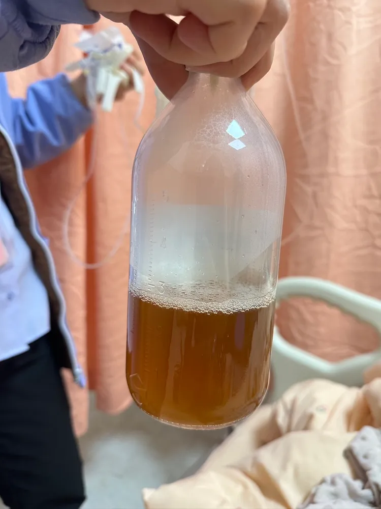 被害人術後解黑尿。陳小姐提供