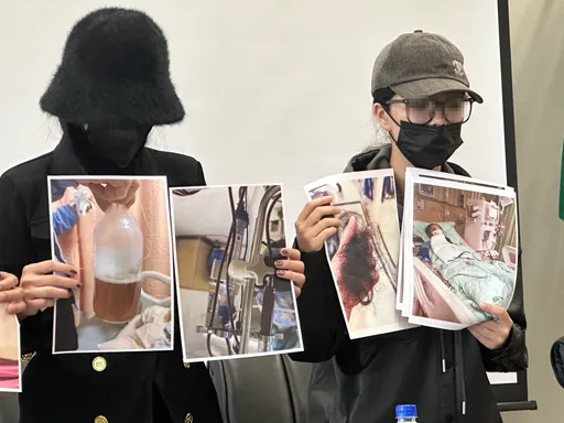 2女相偕隆乳竟解黑尿、狂掉髮！慘洗腎1個月　童顏醫美診所回應了