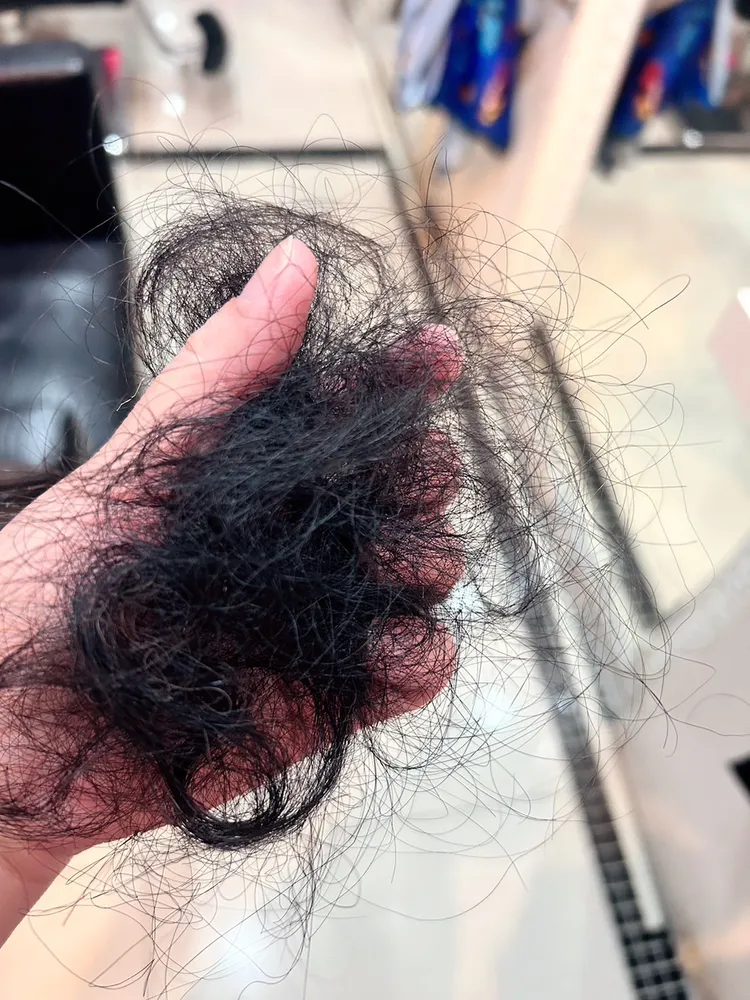 2名被害人術後狂掉髮。陳小姐提供