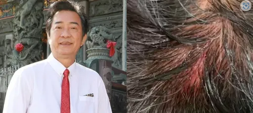 68岁资深演员拍八点档昏倒撞地急送医 头溅血险丢小命
