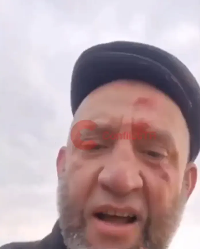 墜機後還能行走自如的倖存者。翻攝自X @miyadhu