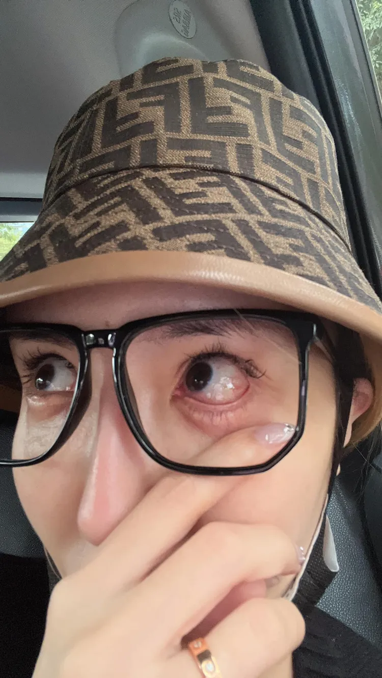 「情色教主」雪碧（方祺媛）懊悔表示，眼肌真的不要提太高，已經半年了，眼睛還是閉不上來。翻攝方祺媛臉書