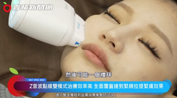 Ｚ音波每次擊發間隔不到0.4秒，提升療程中的舒適度，讓愛美者能夠在短時間內完成治療，無需長時間忍受疼痛及不適感。