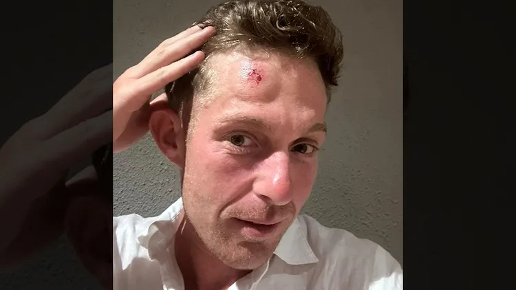 男子po出被高球擊中後額頭的傷勢。翻攝自reddit