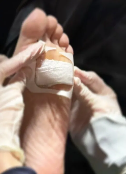 楊謹華腳底插進木頭。翻攝自楊謹華IG