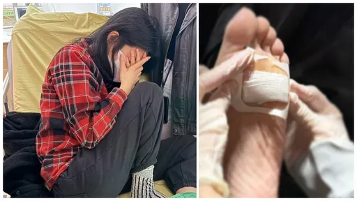 楊謹華「腳被木頭插入」!痛到送急診蜷曲在病床