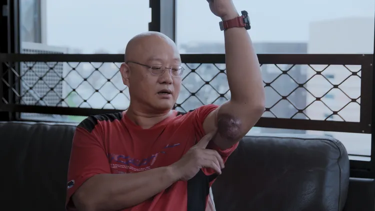 腫瘤本人。台北双喜電影提供