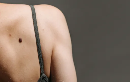 黑色素癌很兇!律師見露背女「有黑點」好心提醒 被回1句糗爆