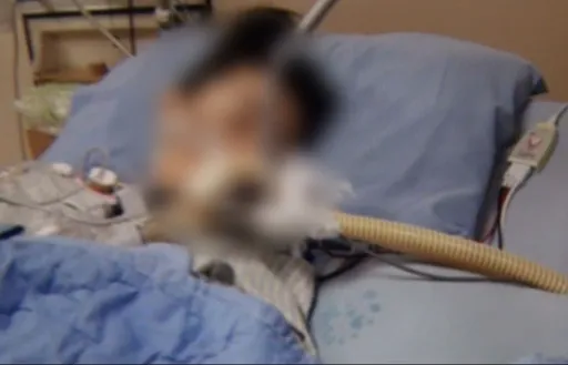 光澤診所麻醉爭議有先例！宜蘭羅東分店6年前也一樁　新手媽「腋下除汗」竟重度昏迷