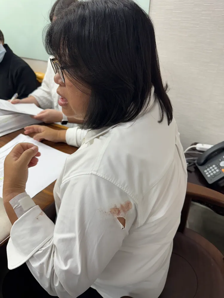 王美惠手臂處明顯有破洞。翻攝王美惠臉書