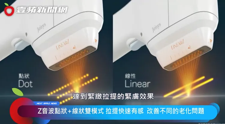 Ｚ音波點狀＋線性雙模式拉提快速有感 能改善不同的老化問題