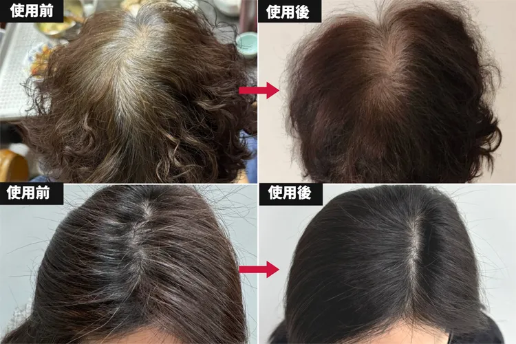 ▲ 無論是重度還是輕度白髮，使用漢芳賦黑露一次，遮白效果就很明顯，持續使用效果更佳。