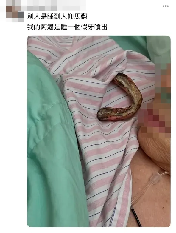 葉姓護理師偷拍病患假牙噴出。取自葉姓護理師Threads