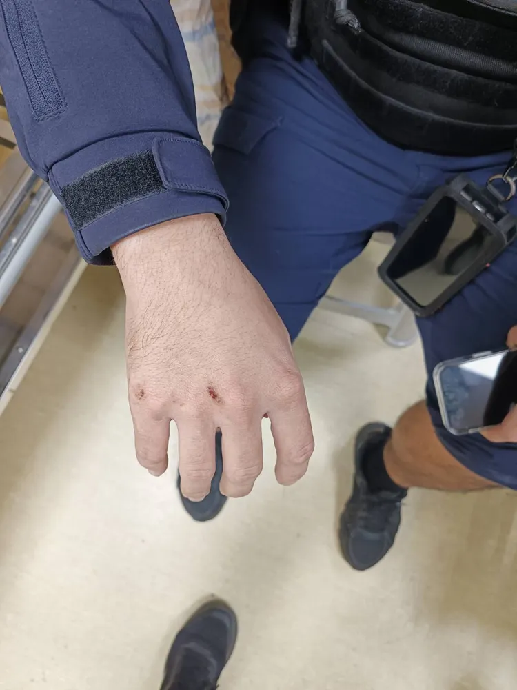 高姓警員遭拖行跌倒，四肢擦傷所幸無生命危險。翻攝畫面