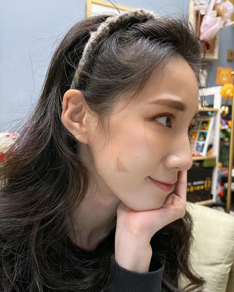 瑤瑤24日在粉專上分享自己被電棒燙燙傷的「破相照」。翻攝《瑤瑤黃喬歆》的粉專