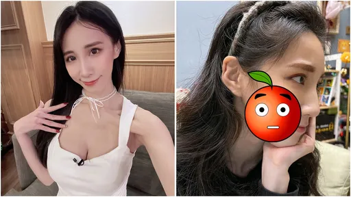 34F女星瑶瑶年前竟「破相」!高温烙印这图案 网友:变鱿鱼游戏了